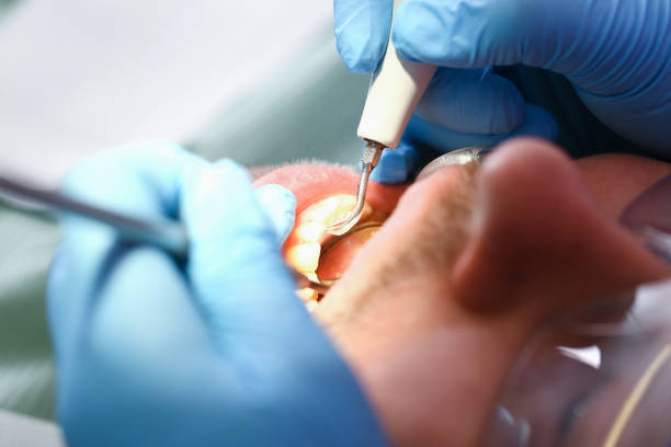 Best Walk-In Emergency Dental Services in Pinckneyvle, IL