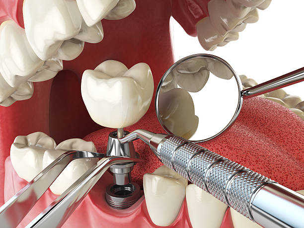 Emergency Care for Swollen Gums