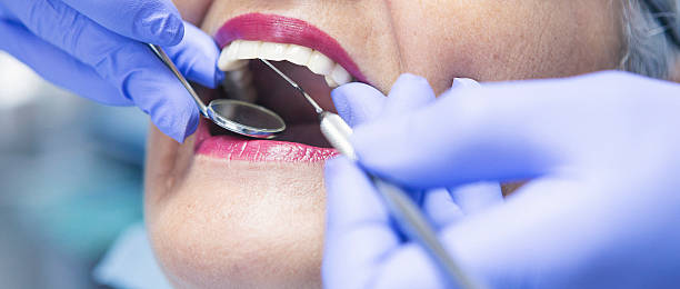 Best 24-Hour Emergency Dental Care in Pinckneyvle, IL